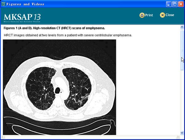 IPB Image